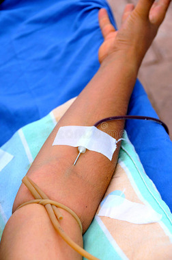 从成年男性手臂抽血