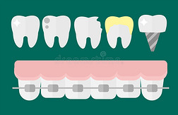 平面保健牙科植牙研究医疗保健理念和医疗器械卫生口腔医学